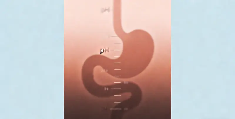 肠癌甲基化检测图3